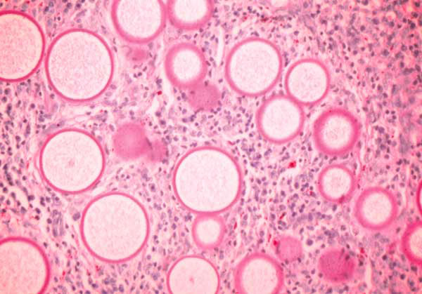 Подкласс Гаплоспоридии (Halposporidia)