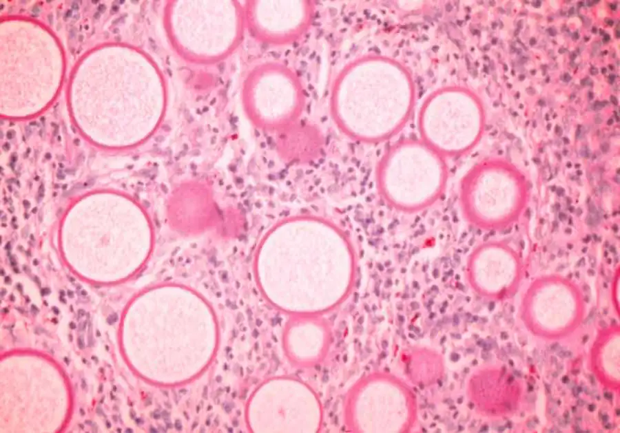 Подкласс Гаплоспоридии (Halposporidia)