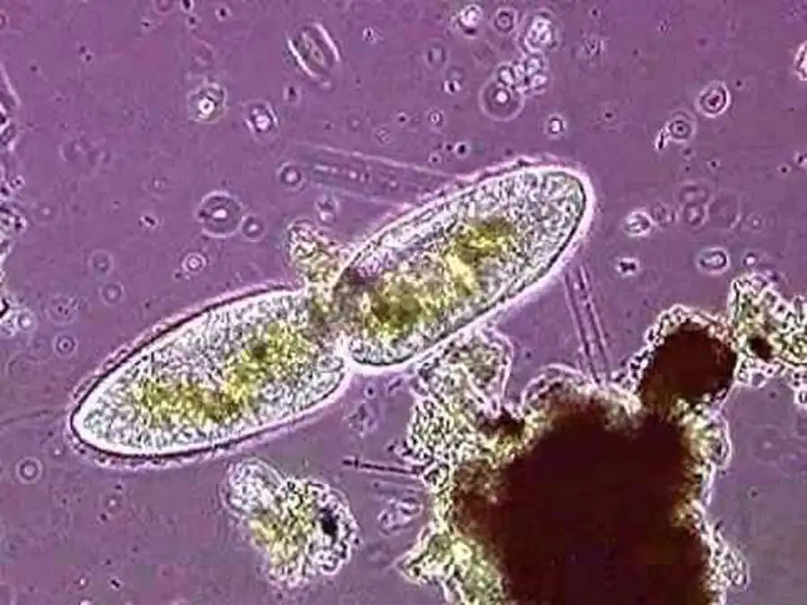 Аутогамия инфузории-туфельки