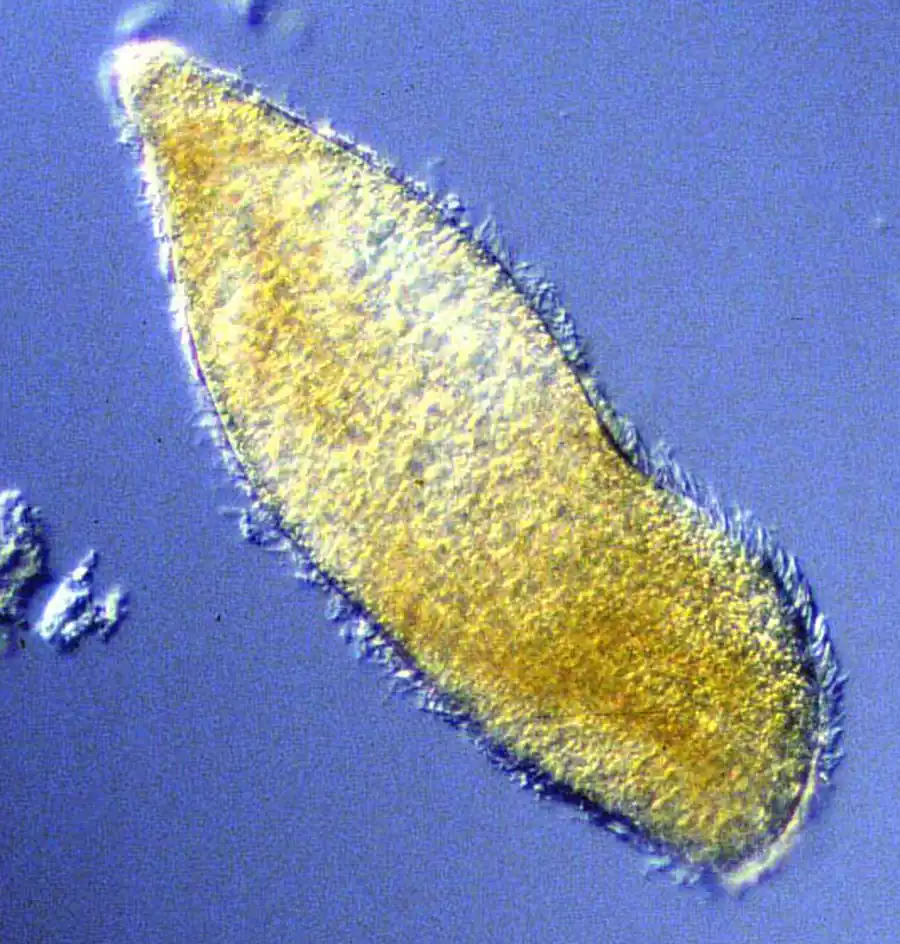 Подкласс Протоцилиаты (Protociliata)