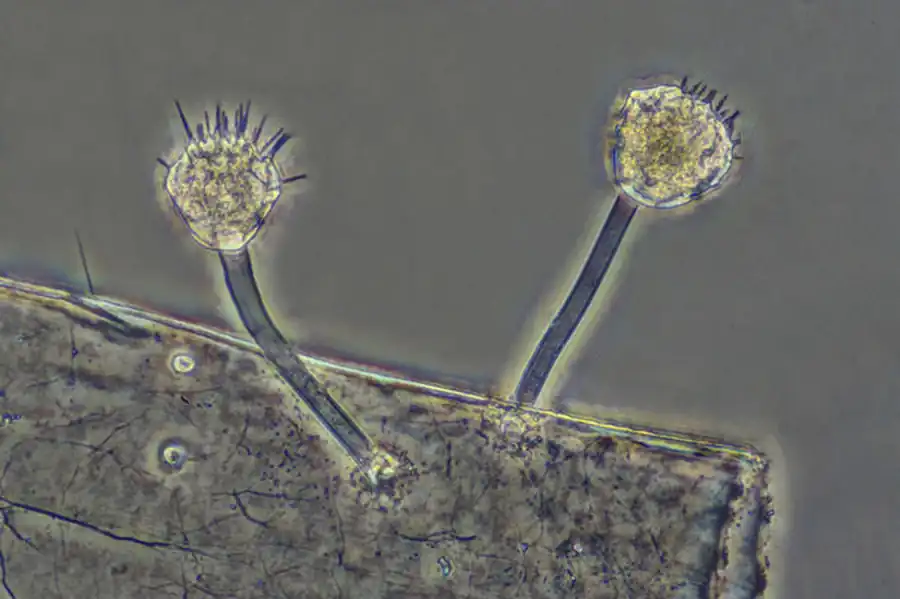 Класс Сосущие Инфузории (Suctoria)