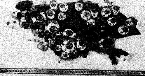 Участок кожи горбатого кита с морскими уточками, Conchoderma auritum