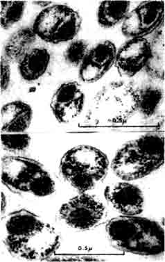 Epitheliocystis. Снимок вида под фазово-контрастным микроскопом.