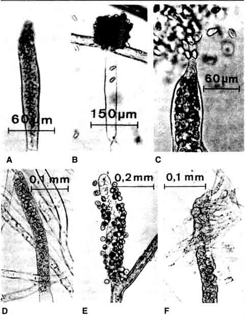 Различные формы спорангиев семейства Saprolegniaceae: