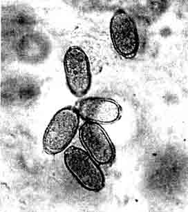 Яйца Capillaria spec, с обеими типичными пробками на концах яйца.
