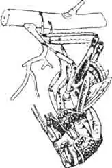 Последняя линька африканской саранчи. Освобождение головы и туловища. (По Kunckel) Последняя линька африканской саранчи. Освобождение головы и туловища. (По Kunckel)