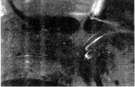 Древолазам (Dendrobates auratus) исполнилось десять дней Древолазам (Dendrobates auratus) исполнилось десять дней