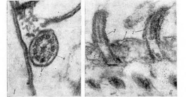Электронная микрофотография срезов ресничек инфузории Ichtiophtirius mullifilis