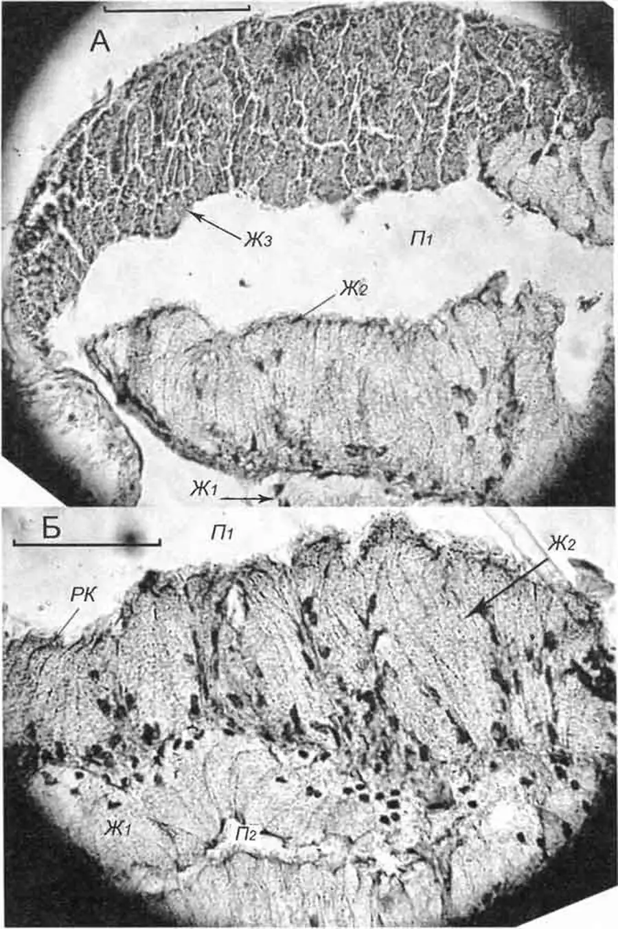 Cincinna macrostoma (Steenbuch) (D 6,0 мм; 18.07.2005): поперечные срезы через дорзальный «карман» (А) и перегородку между «карманами» (Б) синкапсульной железы