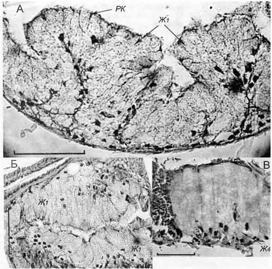 Cincinna macrostoma (Steenbuch) (D 6,0 мм, 18.07.2005): поперечные срезы через участки вентрального «кармана» (А и Б) и дистальный участок (В) синкапсульной железы