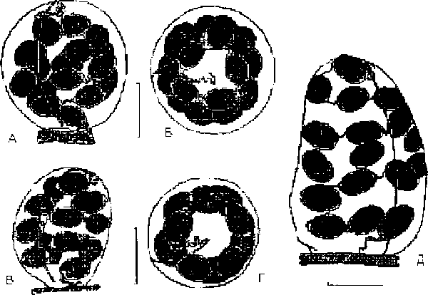 Cincinna antiqua (Sowerby) (А, Б), С. pulchella (Studer) (В, Г), Cincinna umbilicata (Westerlund) (Д)