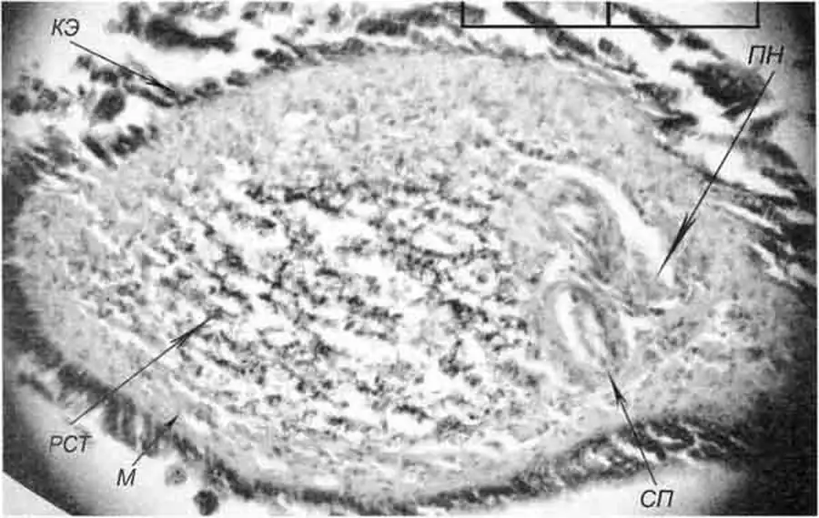 Lithoglyphus naticoides