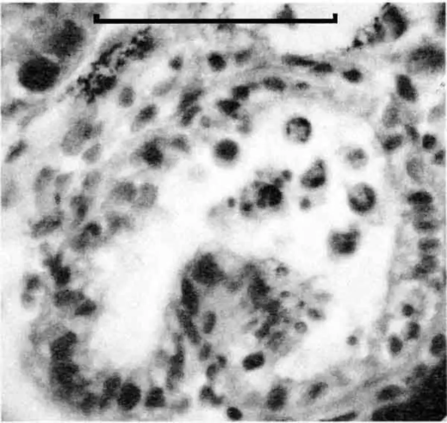 Lithoglyphus naticoides