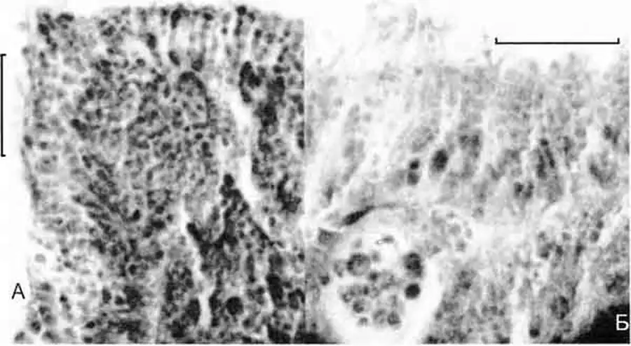 Lithoglyphus naticoides
