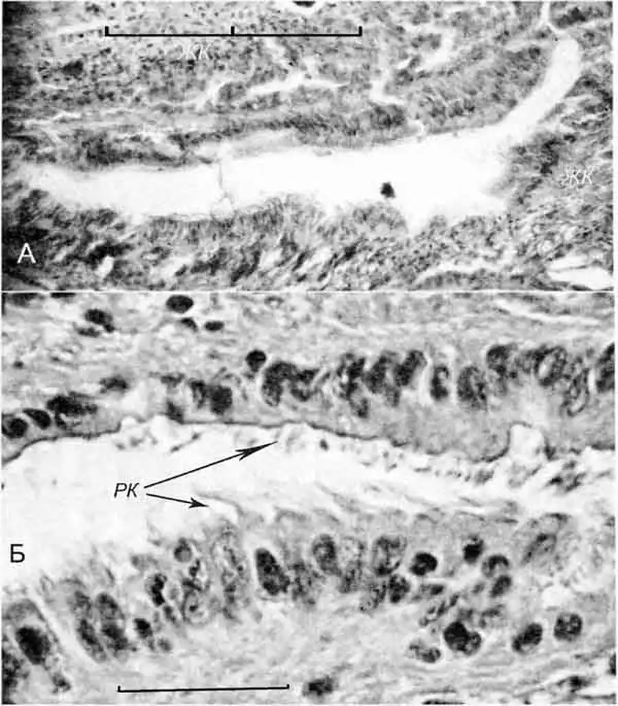 Lithoglyphus naticoides