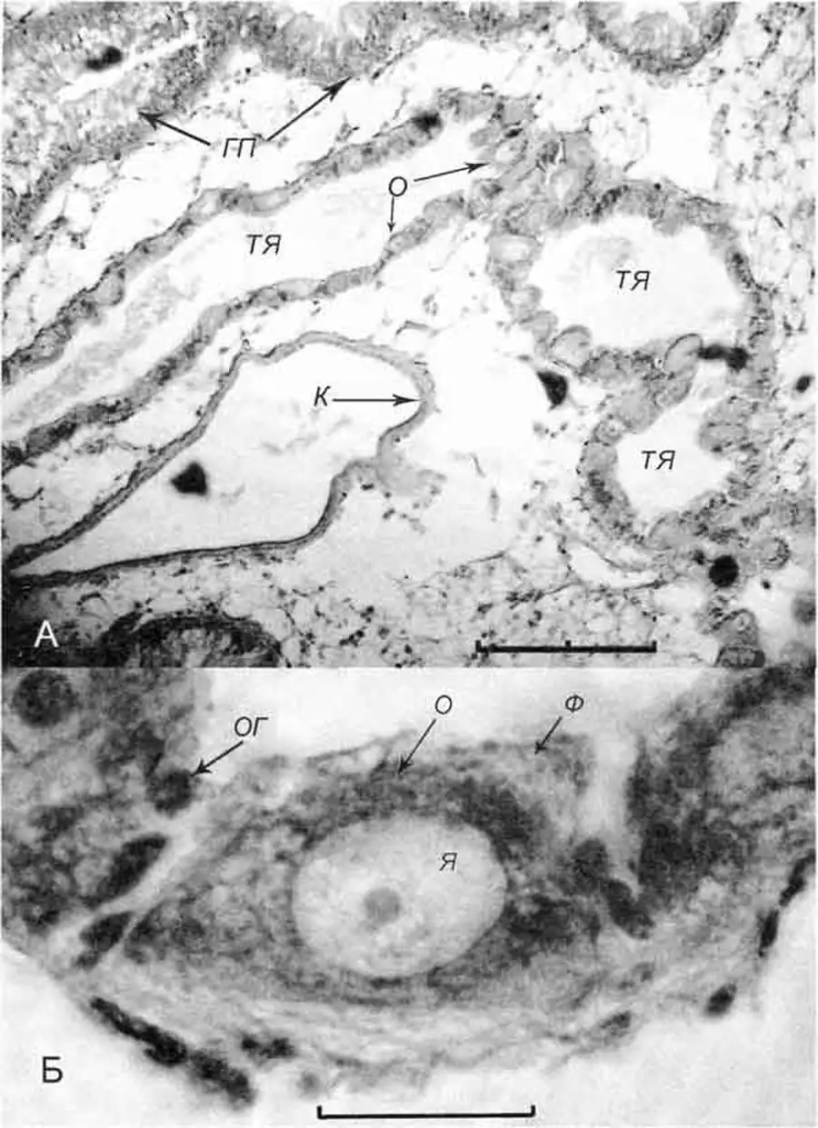 Contectiana listeri