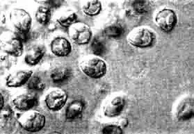 Myxobolus из Cyrtocara moori. Изъятые свежие споры.