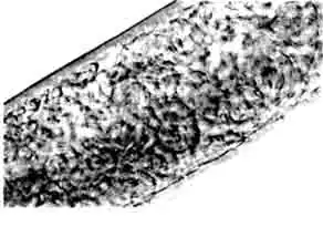 Camallanus cotti. Взрослые самки содержат бесчисленные молодые личинки.