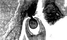 Разрез головной капсулы Camallanus cotti, присосавшейся к стенке кишки.